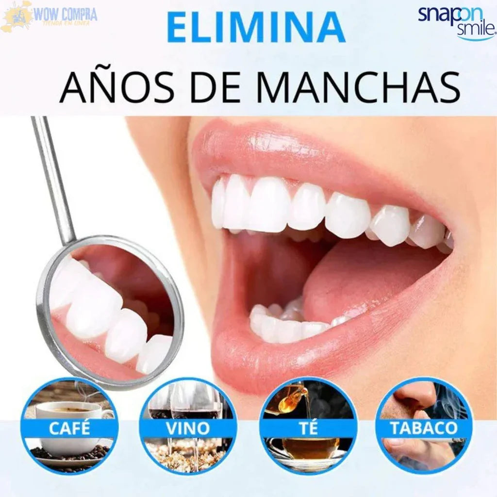 Carillas Dentales Snap on Smile ® |Sonríe con Confianza en Segundos