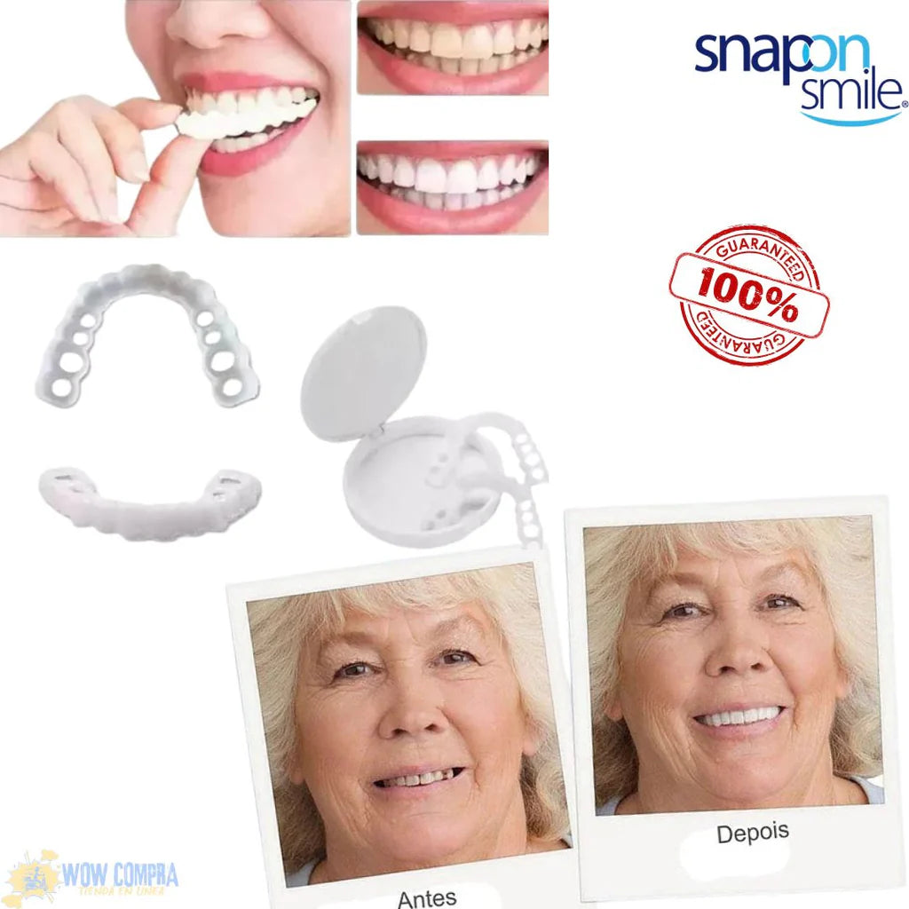 Carillas Dentales Snap on Smile ® |Sonríe con Confianza en Segundos